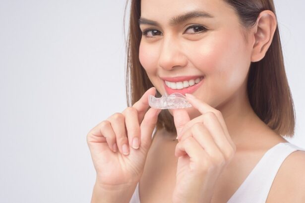 Beautiful Smile with Invisalign