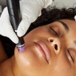 Benefits of Hydrafacial