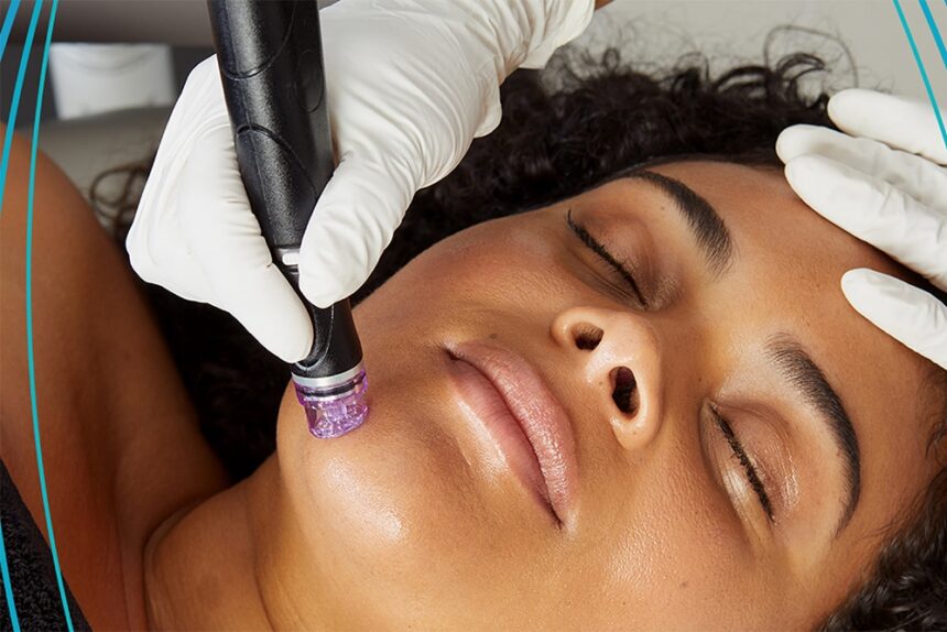 Benefits of Hydrafacial